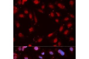 Immunofluorescence analysis of MCF-7 cells using Phospho-CHEK1(S280) Polyclonal Antibody