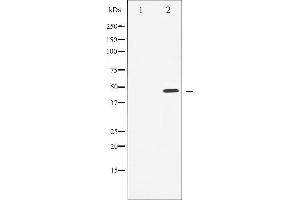 Western blot analysis of Cyclin E1 expression in Paclitaxel treated HeLa whole cell lysates,The lane on the left is treated with the antigen-specific peptide. (Cyclin E1 antibody  (C-Term))