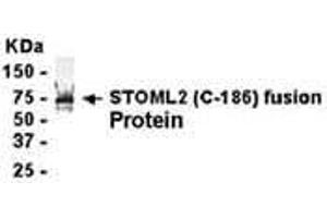 Western Blotting (WB) image for anti-Stomatin (EPB72)-Like 2 (STOML2) (AA 171-356) antibody (ABIN2468107)