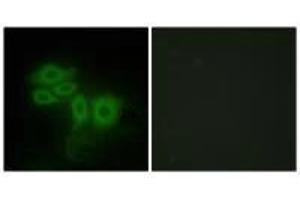 Immunofluorescence analysis of HepG2 cells, using SLK antibody. (SLK antibody  (C-Term))