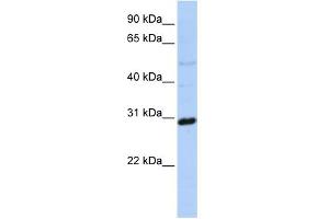 WB Suggested Anti-MTX2 Antibody Titration: 0. (MTX2 antibody  (N-Term))