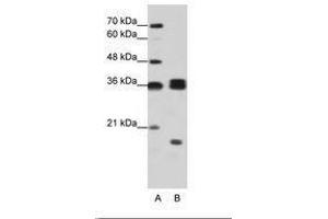 Image no. 2 for anti-Heterogeneous Nuclear Ribonucleoprotein H3 (2H9) (HNRNPH3) (AA 51-100) antibody (ABIN203064) (HNRNPH3 antibody  (AA 51-100))