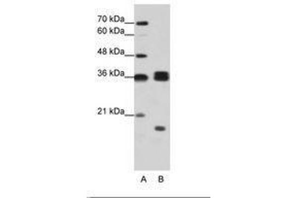 HNRNPH3 Antikörper  (AA 51-100)