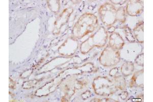 Formalin-fixed and paraffin embedded human kidney labeled with Rabbit Anti-IL-31 Polyclonal Antibody, Unconjugated  at 1:200 followed by conjugation to the secondary antibody and DAB staining (IL-31 antibody  (AA 31-130))
