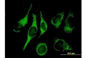 Immunofluorescence of purified MaxPab antibody to HADH2 on HeLa cell. (HSD17B10 antibody  (AA 1-261))