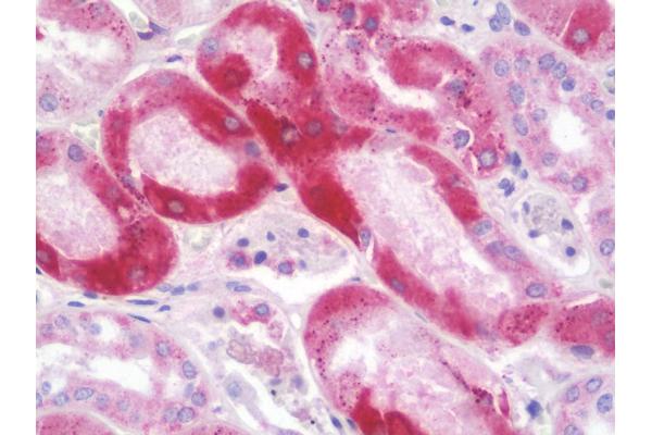 ERAP2 antibody  (N-Term)