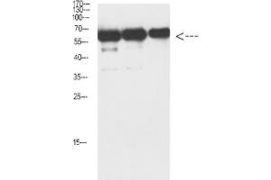 Western Blot analysis of Luciferase protein using antibody diluted at 1:1000. (Luciferase antibody)