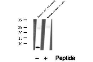 Western blot analysis of extracts of human skeletal muscle tissue, using TMSB4X antibody.