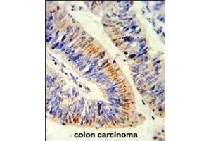 Immunohistochemistry (Paraffin-embedded Sections) (IHC (p)) image for anti-Nuclear Factor-kB p65 (NFkBP65) (AA 10-37), (N-Term) antibody (ABIN1882124)