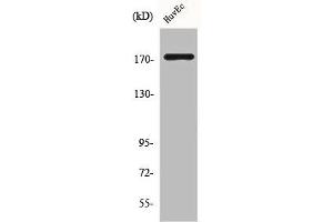 Western Blot analysis of HuvEc cells using COL11A2 Polyclonal Antibody (COL11A2 antibody  (C-Term))