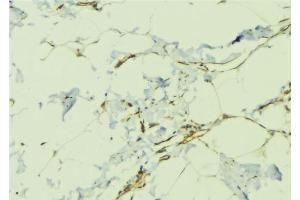 ABIN6276479 at 1/100 staining Human lung tissue by IHC-P. (TDGF1 antibody  (Internal Region))