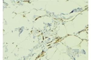 ABIN6276479 at 1/100 staining Human lung tissue by IHC-P. (TDGF1 antibody  (Internal Region))