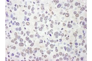 anti-eIF4AIII/EIF4A3 (AA 125-175) antibody