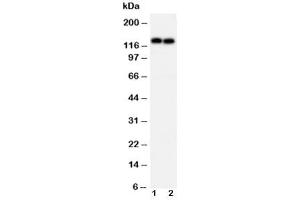 Western blot testing of N-Cadherin antibody and Lane 1:  MCF-7
