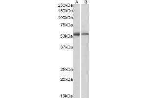 ABIN185060 (1µg/ml) staining of Human (A) and Mouse (B) Thymus lysate (35µg protein in RIPA buffer). (FAF2 antibody  (C-Term))