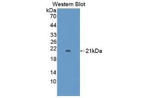Western blot analysis of the recombinant protein. (OPA3 antibody  (AA 23-179))