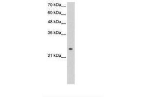 Image no. 1 for anti-Alcohol Dehydrogenase 6 (Class V) (ADH6) (AA 215-264) antibody (ABIN203376) (ADH6 antibody  (AA 215-264))