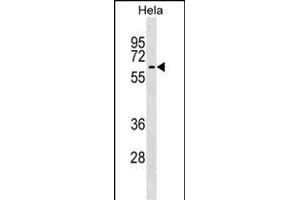 KLHL12 Antibody (C-term) (ABIN1537222 and ABIN2848955) western blot analysis in Hela cell line lysates (35 μg/lane).