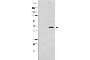 Western blot analysis of Synaptotagmin phosphorylation expression in Sobital treated 293 whole cell lysates,The lane on the left is treated with the antigen-specific peptide. (Synaptotagmin antibody  (pSer309))