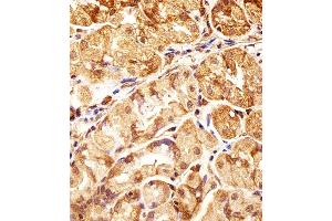 Immunohistochemical analysis of paraffin-embedded H. (POLDIP3 antibody  (N-Term))