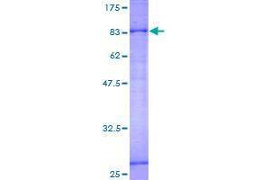 Image no. 1 for Solute Carrier Family 27 (Fatty Acid Transporter), Member 6 (SLC27A6) (AA 1-619) protein (GST tag) (ABIN1320341) (SLC27A6 Protein (AA 1-619) (GST tag))