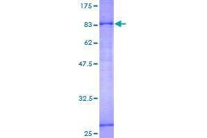 Image no. 1 for Solute Carrier Family 27 (Fatty Acid Transporter), Member 6 (SLC27A6) (AA 1-619) protein (GST tag) (ABIN1320341)