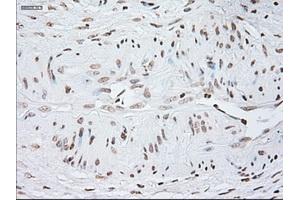 Image no. 1 for anti-Glial Fibrillary Acidic Protein (GFAP) antibody (ABIN1498440) (GFAP antibody)
