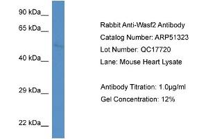WB Suggested Anti-Wasf2 Antibody   Titration: 1. (WASF2 antibody  (N-Term))