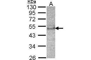 WB Image Sample(30 μg of whole cell lysate) A:HeLa S3, 12% SDS PAGE antibody diluted at 1:200 (SOCS4 antibody  (C-Term))