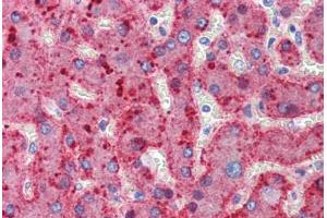 Human Liver (formalin-fixed, paraffin-embedded) stained with ALPL antibody ABIN462352 followed by biotinylated anti-mouse IgG secondary antibody ABIN481714, alkaline phosphatase-streptavidin and chromogen. (ALPL antibody)