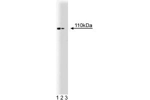 Western blot analysis of Hsp110 on a rat cerebrum lysate. (HSPA4 antibody  (AA 703-858))