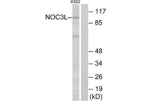 Western Blotting (WB) image for anti-Nucleolar Complex Associated 3 Homolog (NOC3L) (Internal Region) antibody (ABIN6300703) (NOC3L antibody  (Internal Region))