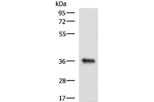 Western blot analysis of Mouse liver tissue lysate using GRHPR Polyclonal Antibody at dilution of 1:900 (GRHPR antibody)