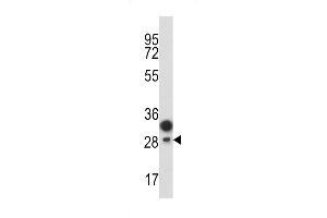 Western blot analysis of C antibody (Center) (ABIN389416 and ABIN2839501) in T47D cell line lysates (35 μg/lane). (PROCR antibody  (AA 104-132))