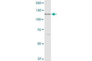 RECK MaxPab rabbit polyclonal antibody. (RECK antibody  (AA 1-971))