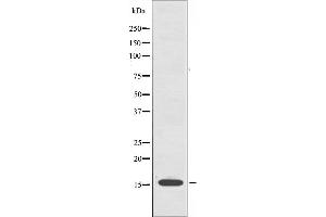 Western blot analysis of extracts from A549 cells, using CYB5 antibody.