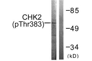 Western Blotting (WB) image for anti-Checkpoint Kinase 2 (CHEK2) (pThr383) antibody (ABIN1847336) (CHEK2 antibody  (pThr383))