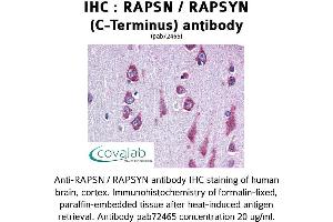Image no. 1 for anti-Receptor-Associated Protein of The Synapse (RAPSN) antibody (ABIN1738731) (RAPSN antibody)