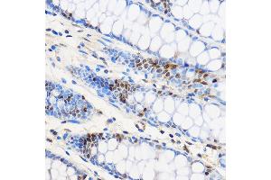 Immunohistochemistry of paraffin-embedded Human colon using ZNF263 Rabbit pAb (ABIN7271472) at dilution of 1:100 (40x lens). (ZNF263 antibody  (AA 120-240))