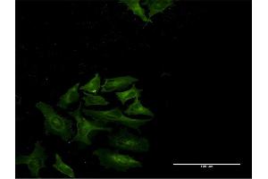 Immunofluorescence of monoclonal antibody to STAT4 on HeLa cell. (STAT4 antibody  (AA 1-748))