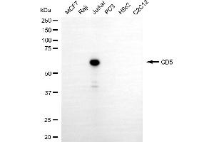 Western blotting analysis using CD5 antibody (ABIN7797975).