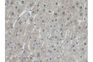 Detection of EEF1a1 in Human Liver Tissue using Polyclonal Antibody to Eukaryotic Translation Elongation Factor 1 Alpha 1 (EEF1a1) (eEF1A1 antibody  (AA 1-241))