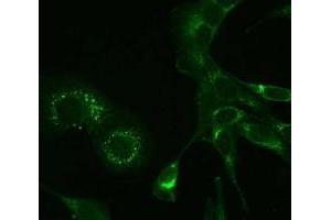 Immunofluorescence (IF) image for anti-MHV NSP9 antibody (ABIN400814) (MHV NSP9 antibody)