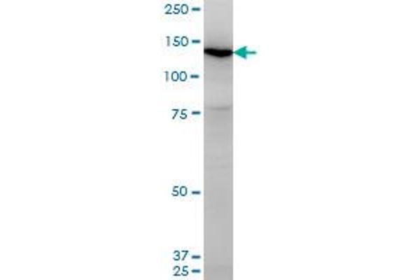 UNC13D Antikörper  (AA 2-100)