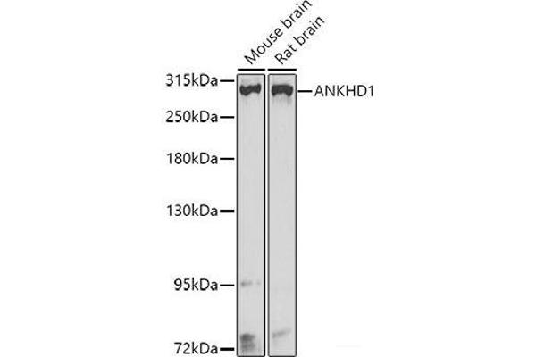 ANKHD1 抗体