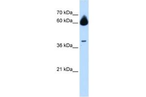 Western Blotting (WB) image for anti-Matrix Metallopeptidase 23B (MMP23B) antibody (ABIN2463013) (MMP23B antibody)