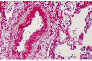 Human Lung: Formalin-Fixed, Paraffin-Embedded (FFPE) (Elastin antibody)