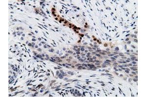 Image no. 6 for anti-EPM2A (Laforin) Interacting Protein 1 (EPM2AIP1) antibody (ABIN1498047) (EPM2AIP1 antibody)