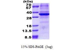 SDS-PAGE (SDS) image for Carbonic Anhydrase XI (CA11) (AA 24-328) protein (His tag) (ABIN5853103) (CA11 Protein (AA 24-328) (His tag))