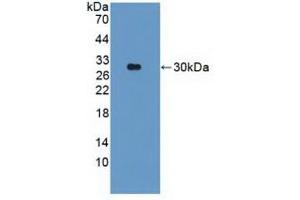 Detection of Recombinant PARK2, Human using Polyclonal Antibody to Parkinson Disease Protein 2 (PARK2) (Parkin antibody  (AA 229-465))
